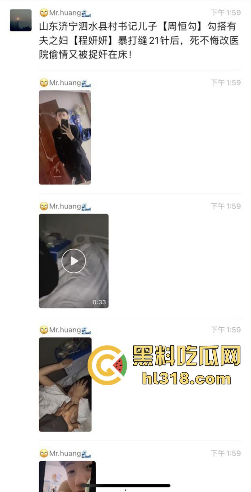 山东济宁泗水县书记儿子【周恒勾】，勾搭撩骚有夫之妇【程妍妍】，被夫家暴打缝21针，竟再次医院偷情 ！