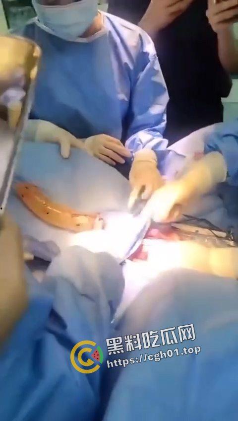 活久见！超大假阳具塞进体内拿不出来只能做手术 你们男同玩的都这么狠吗