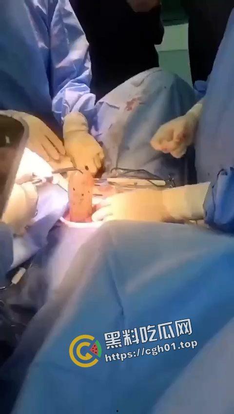 活久见！超大假阳具塞进体内拿不出来只能做手术 你们男同玩的都这么狠吗-2