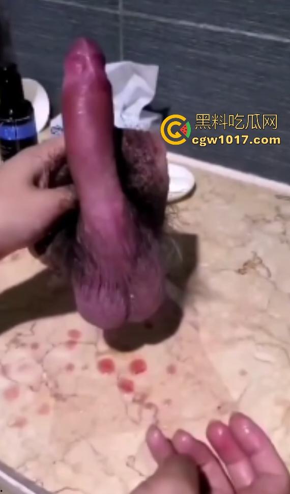 泰国自宫狂人嫌医院贵在家自割巨屌,落地后鸡巴还梆硬,后悔失去这武器,老爸见状怒吼“滚出家门”!-5