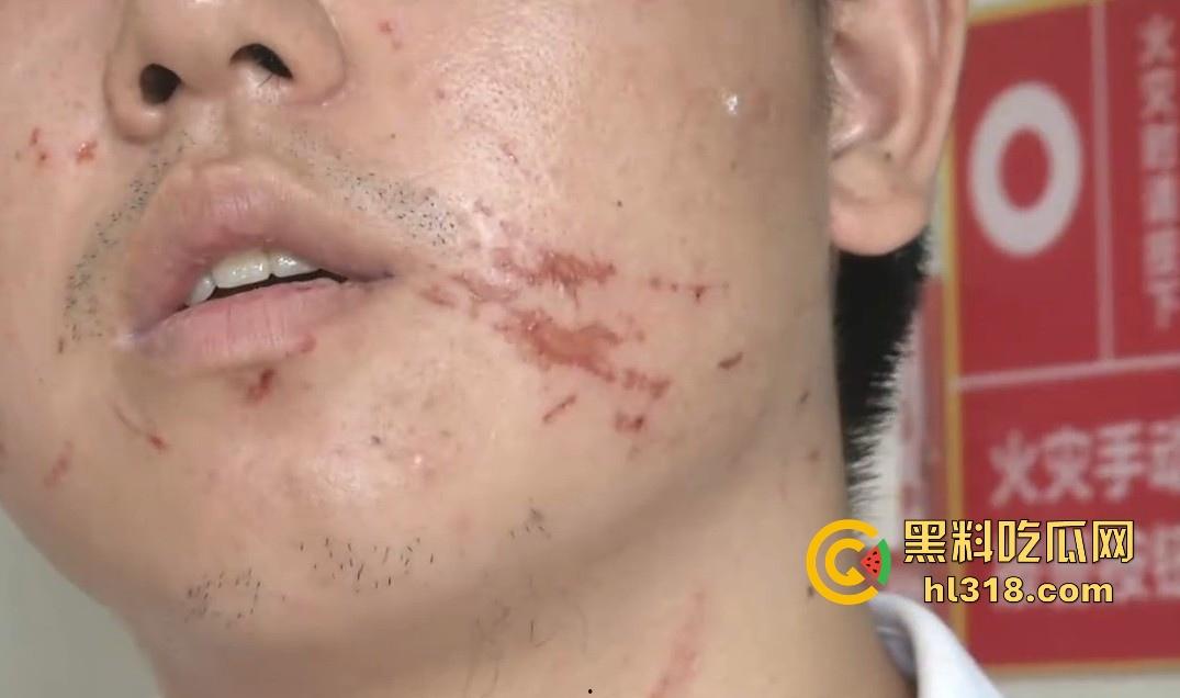 小哥网上想约炮台球助教,想摸人家的丝袜美腿,不料线下被坑5000多,还给打了一顿,真是陪了夫人又折兵!-9