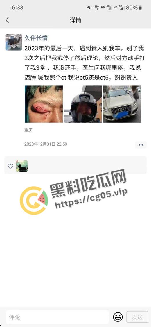 新年遇贵人!重庆渝中摩托佬莫名其妙被奥迪别车三次还挨打 事后律师表示不会少于五万 挨打挨出来一辆新摩托-1