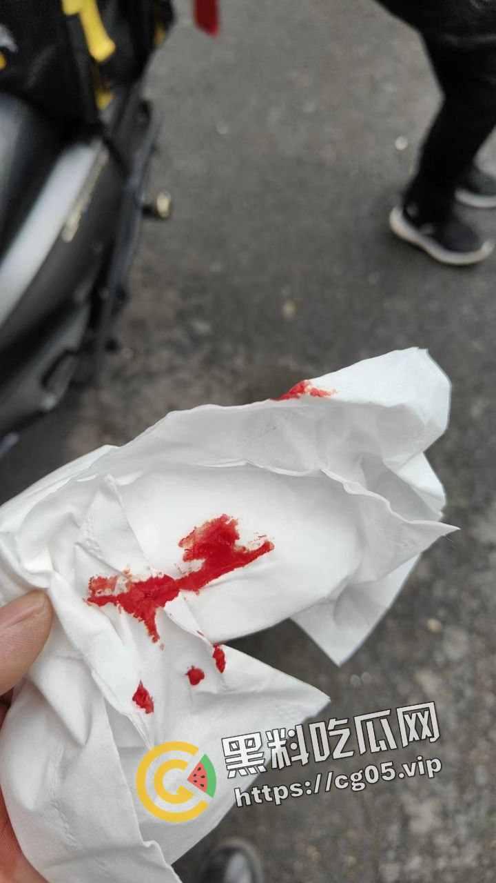 新年遇贵人!重庆渝中摩托佬莫名其妙被奥迪别车三次还挨打 事后律师表示不会少于五万 挨打挨出来一辆新摩托-6