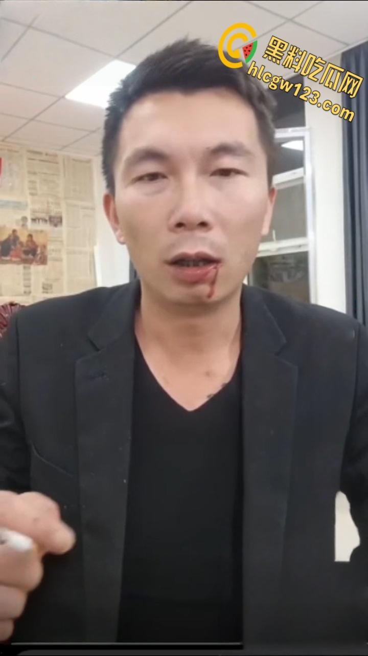 抖音狠人博流量 , 鞭炮嘴炸出血，脑残操作震惊全网 ！-6