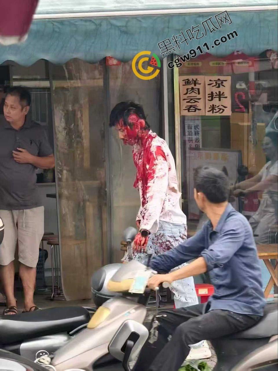 广西柳州街头疯狂砍人事件!男子疯狂持刀追砍,残暴削掉头皮,引爆全城惊恐!-6