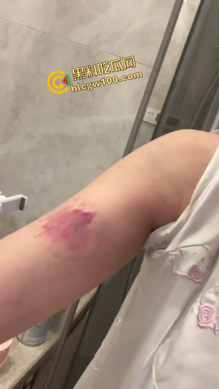 街球圈情侣大瓜！杭州街球手【程鑫凯】家暴女网红【鸡腿诺】多处打伤哭泣现场！独家开盒流出！-16