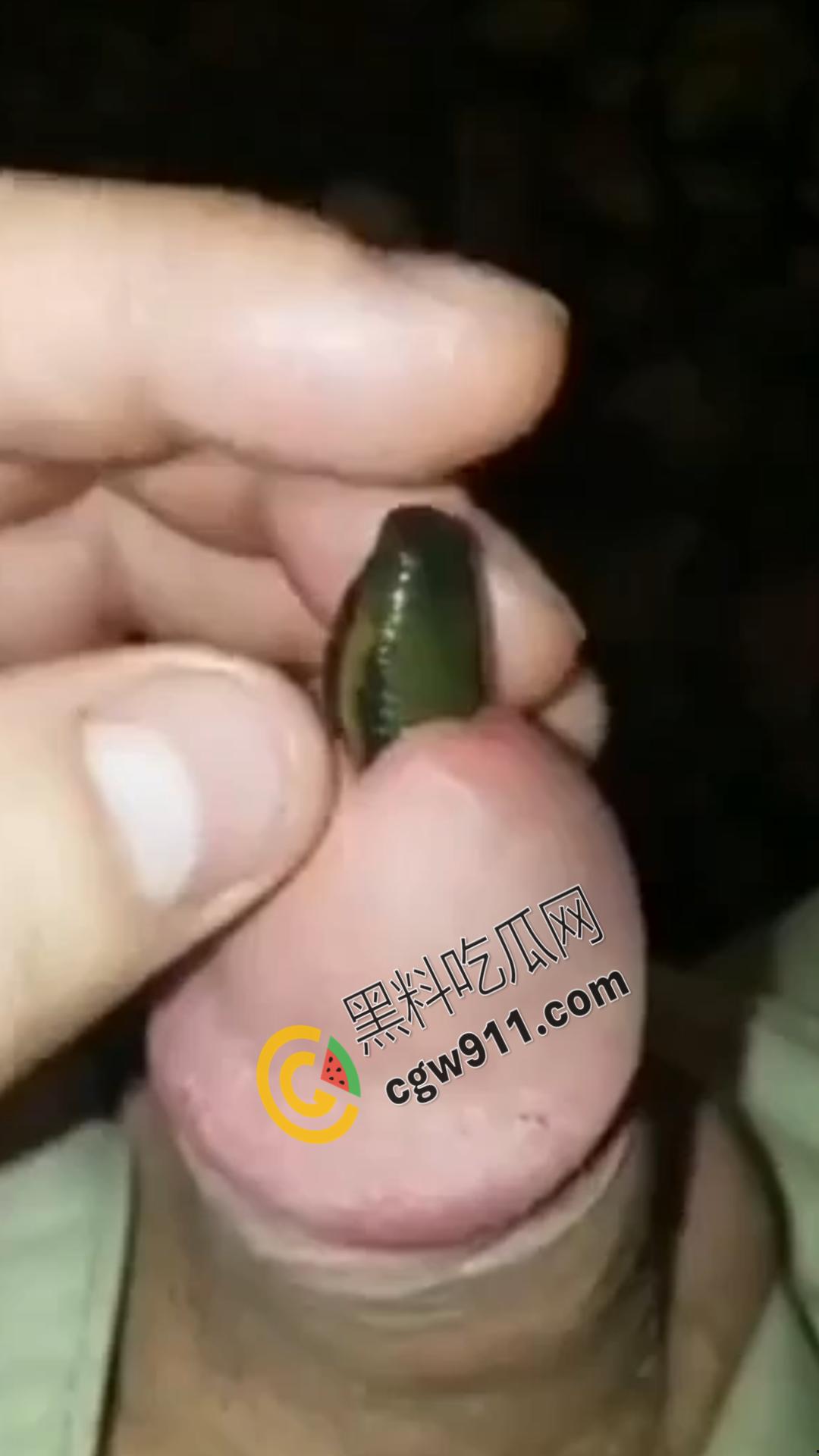恐怖刺激!活蚂蟥钻入男子大屌的惊悚作死视频,观看者直呼恶心,视觉冲击骇人听闻-4