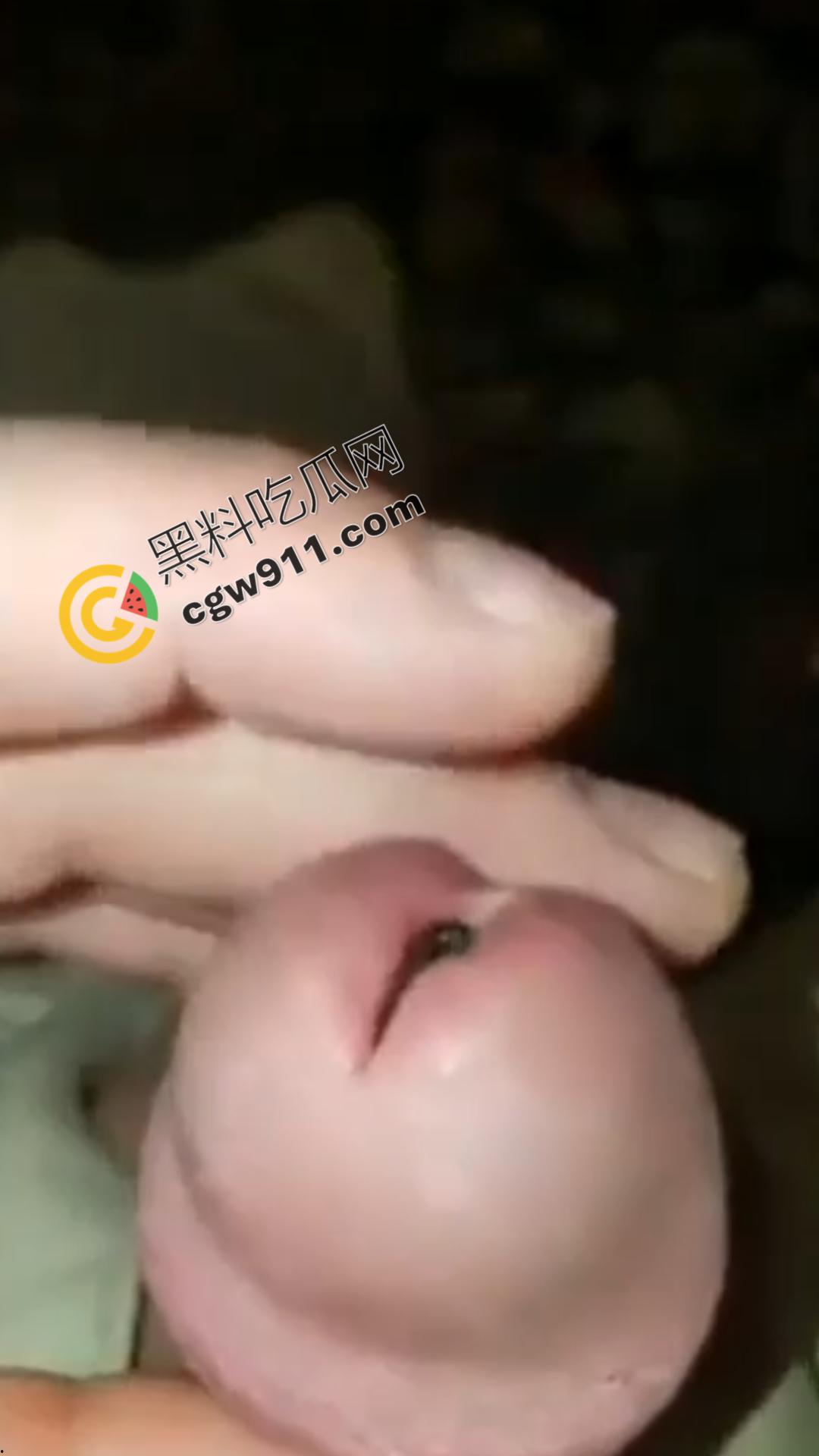 恐怖刺激!活蚂蟥钻入男子大屌的惊悚作死视频,观看者直呼恶心,视觉冲击骇人听闻-5