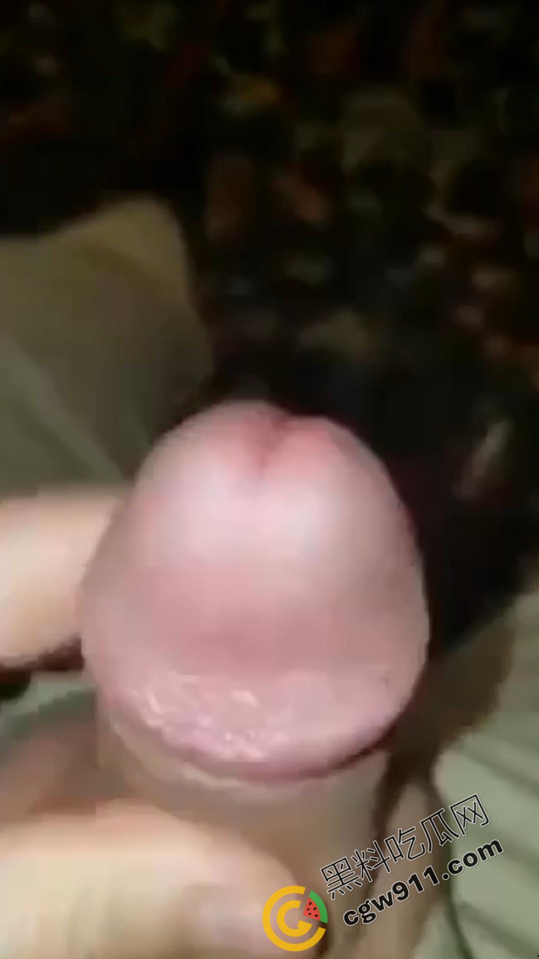 恐怖刺激!活蚂蟥钻入男子大屌的惊悚作死视频,观看者直呼恶心,视觉冲击骇人听闻-6